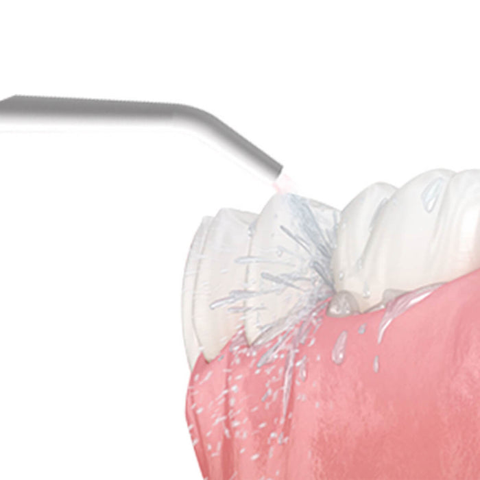 Irrigador bucal limpiador dental blanco marca Kalley
